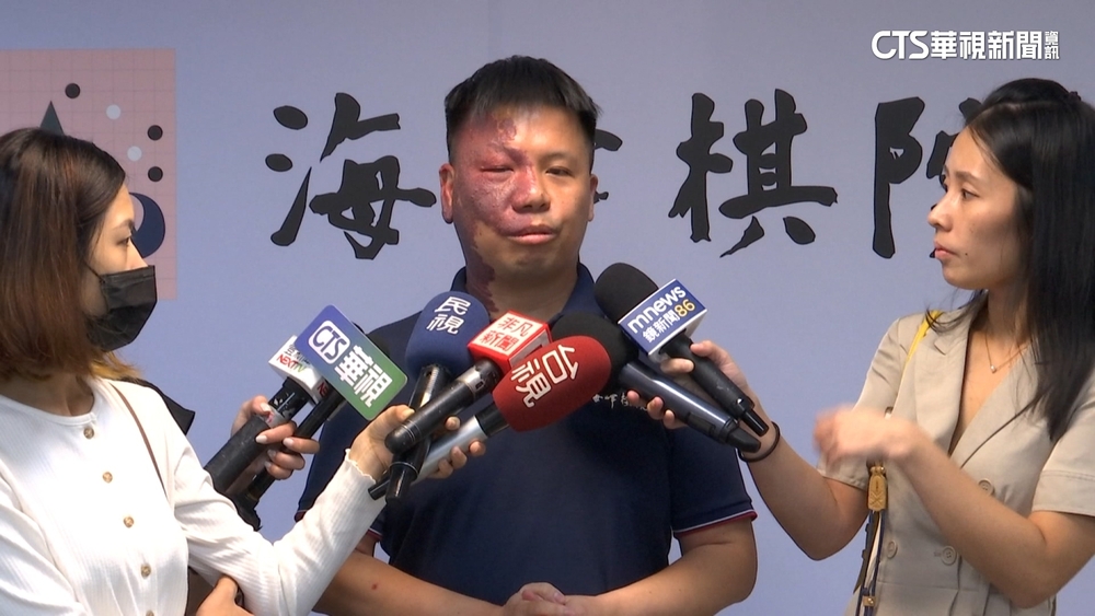 女棋士控摸背性騷　台灣棋王周俊勳駁：子虛烏有