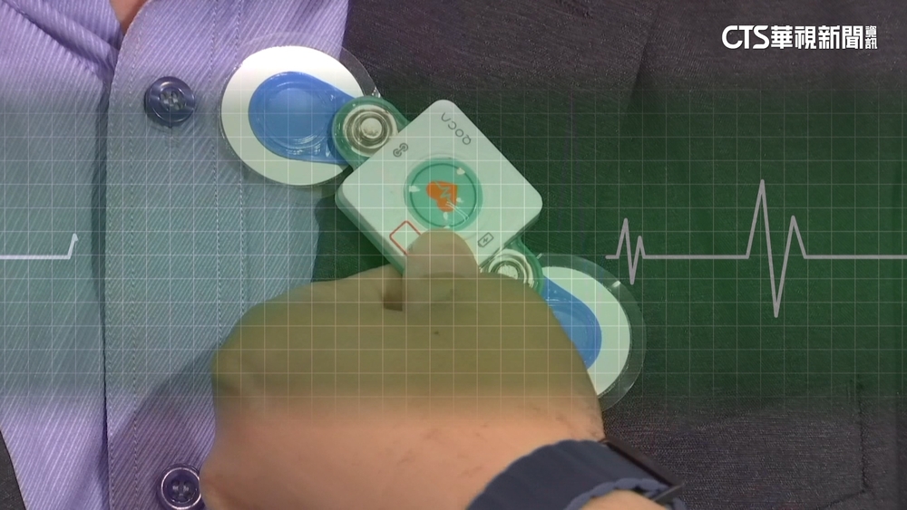 不再當電線人就能測睡眠　「攜帶式儀器」準確度9成5