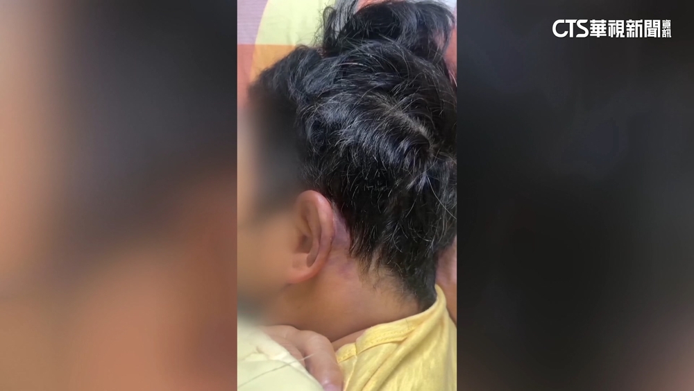 招牌擋騎樓！　婦用腳移開遭毆腦震盪　店家認打人道歉