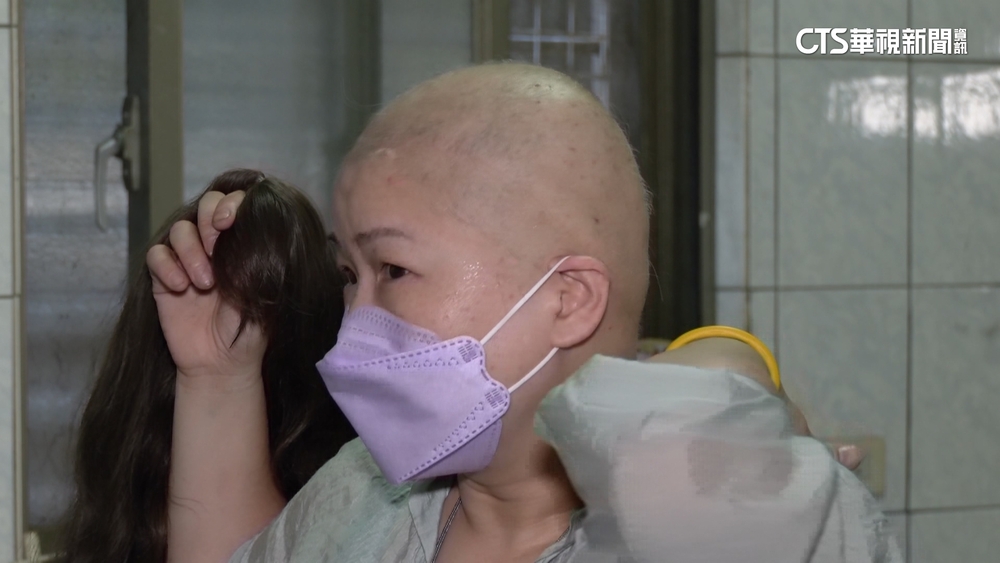 打完莫德納後狂掉髮！　女個案2年後獲3萬救濟金