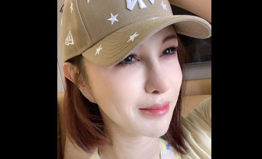 利菁突發文「要排隊換眼角膜」　疑眼睛受損嚴重等待捐贈：堅強面對