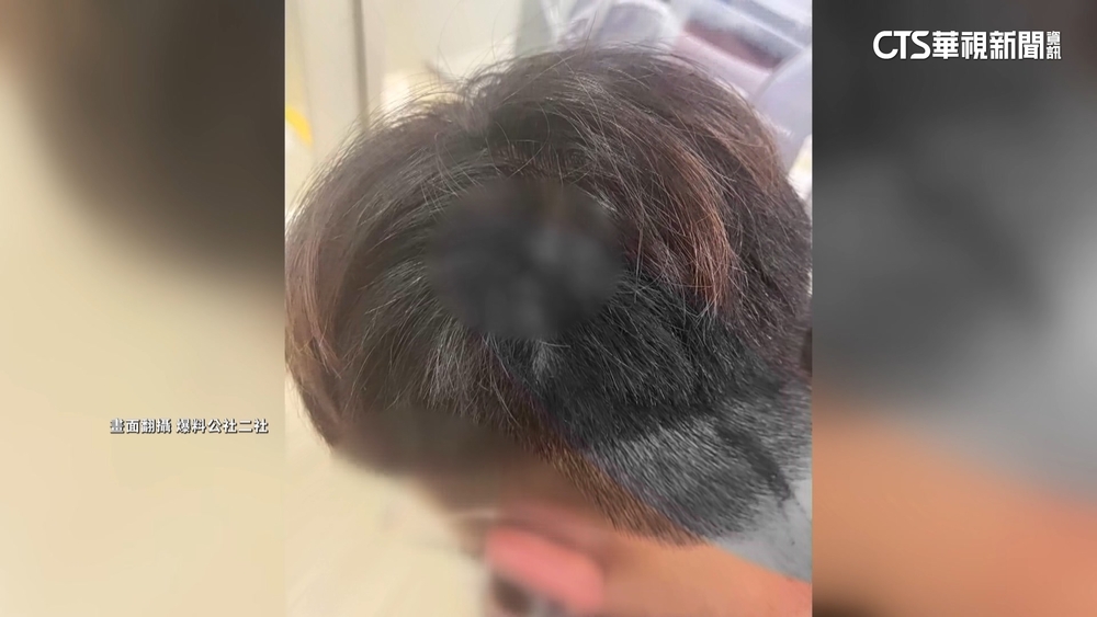 逛超商遭刺傷　被害人控報案後嫌帶人衝警局叫囂