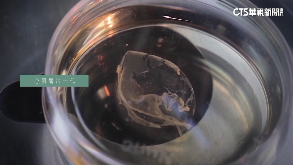 牙科加入AI運算　分析治療史助醫師判讀