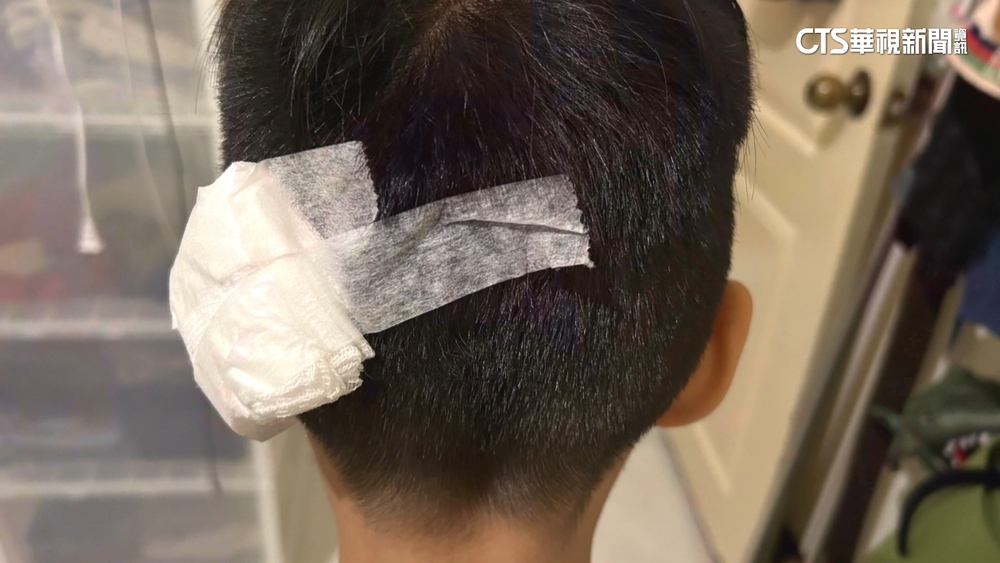 百貨室內樂園遊具設計不良　男童遭「撞破頭」