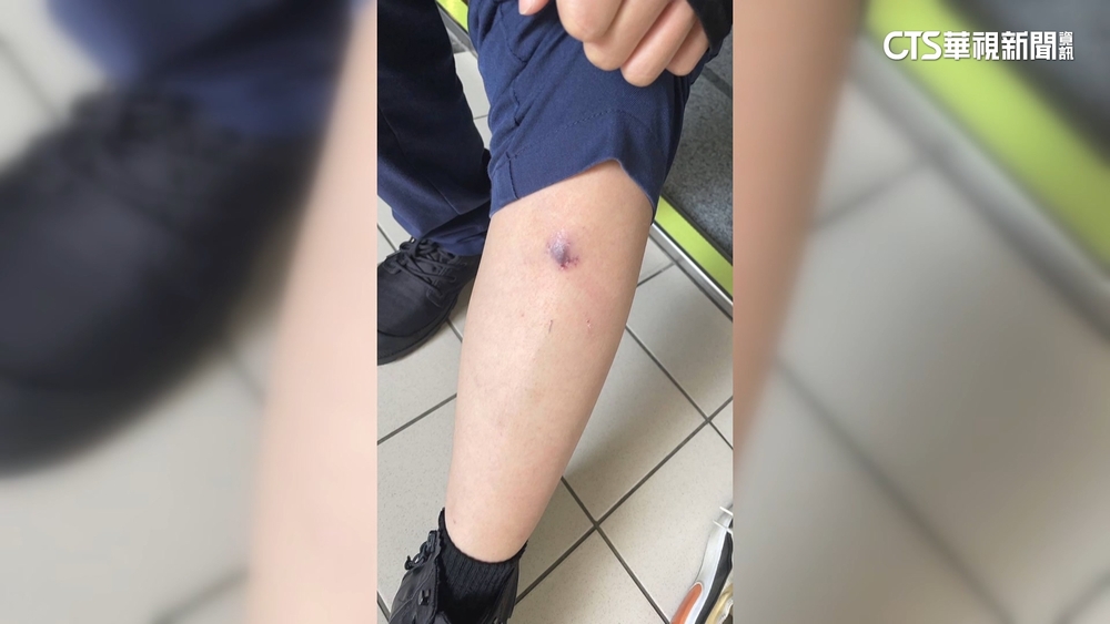 誇張！飼主明知狗會咬人　蓄意開門放狗咬警察