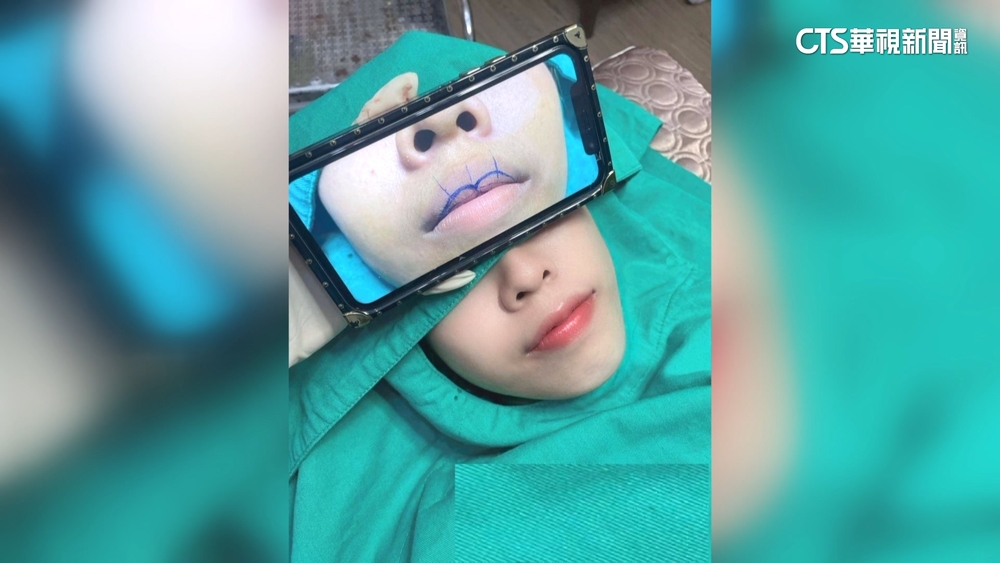 越南辣妹開醫美工作室　價格低廉6年海撈百萬