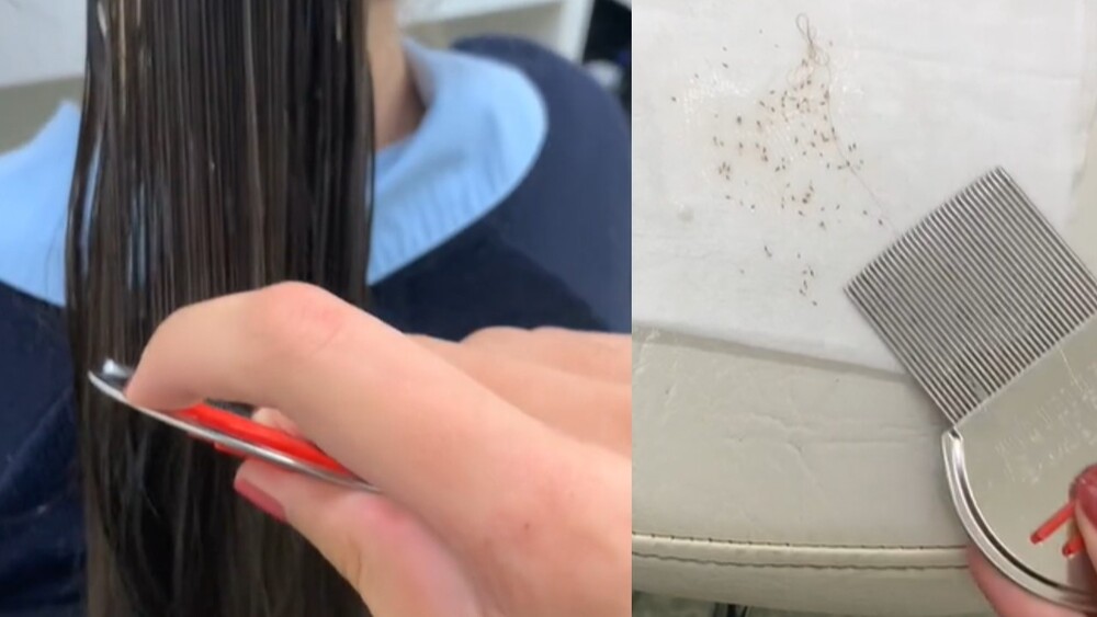 少女飄逸長髮一梳　「上百顆頭蝨卵」全刮出　美髮師傻眼