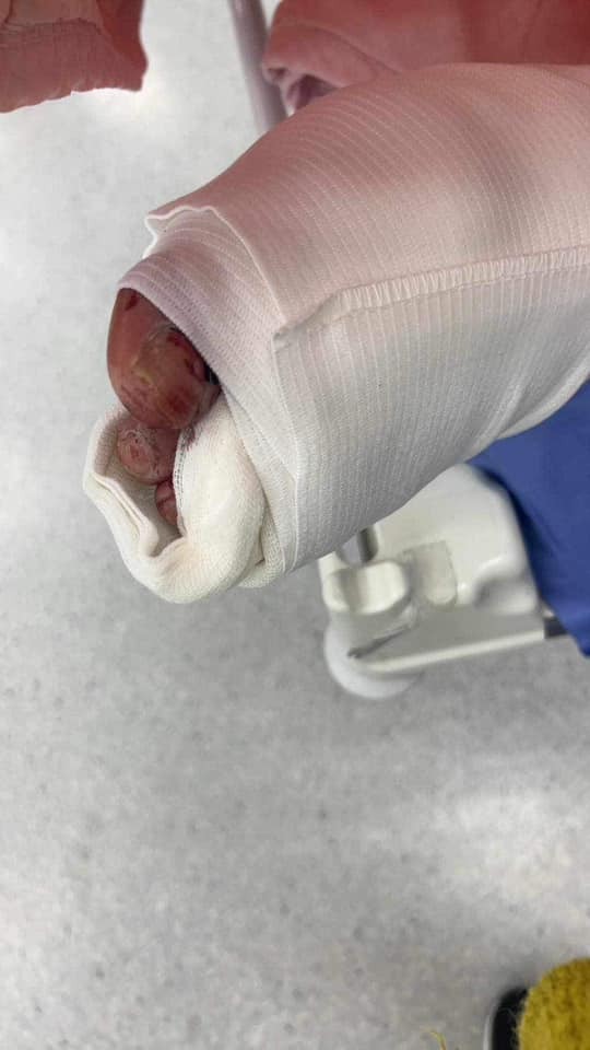 聶姓男子目前仍在醫院治療。圖/翻攝自「我是湖口人」臉書社團