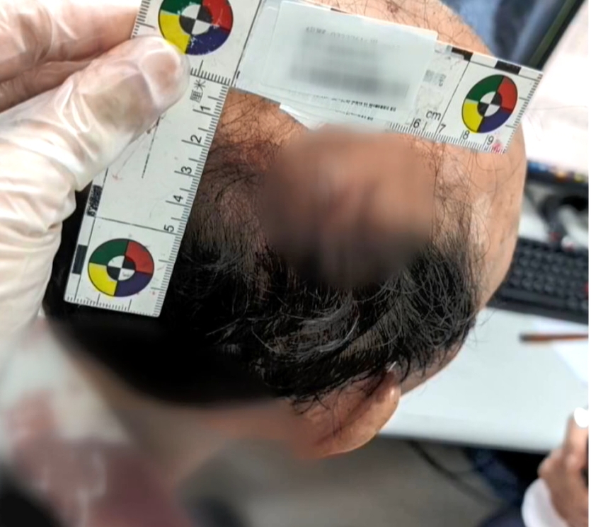 郵局值班經理因與歹徒扭打而受傷。圖／資料照