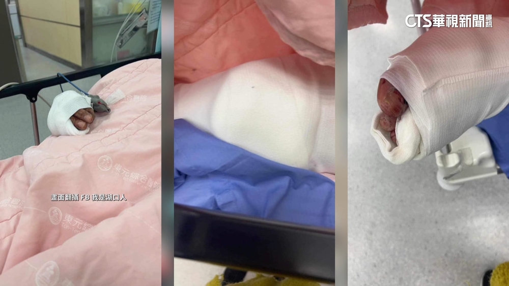 懷疑女友出軌誤認「砍錯人」　勇父護幼女遭斷指！