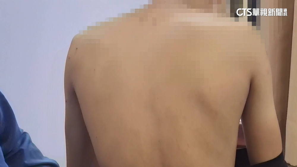 執法過當！　桃3警涉暴力刑求少年　3警法辦.所長調職