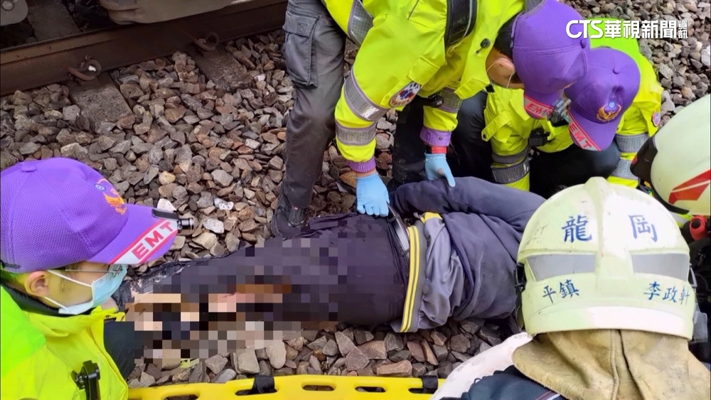 持「鐵桿」觸「電車線」昏厥　民眾全身約4成燒燙傷