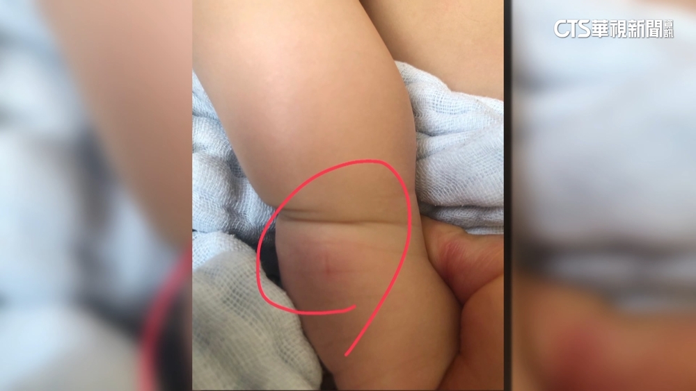 澎湖兒少館草地藏「繩索陷阱」　1歲童遭絆倒跌傷