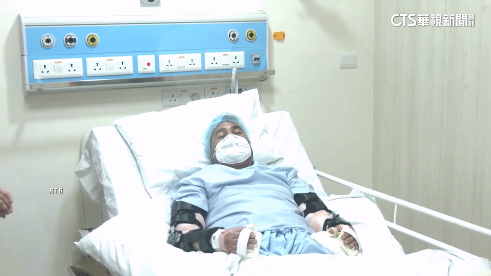 印畫家遭火車撞斷雙臂　等4年手術接上女子手臂