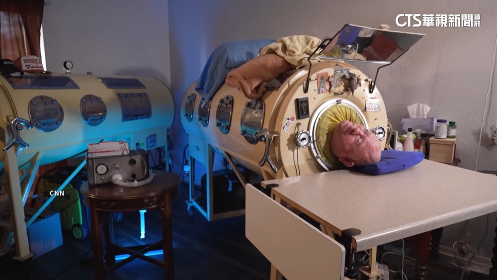 靠鐵肺存活70年　「鐵肺裡的男人」傳奇亞歷山大過世