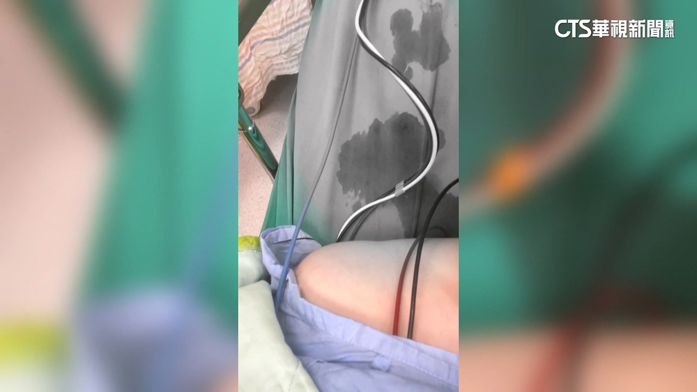 港媒體人「姜牧師」在台返家遇刺　氣血胸送醫直播