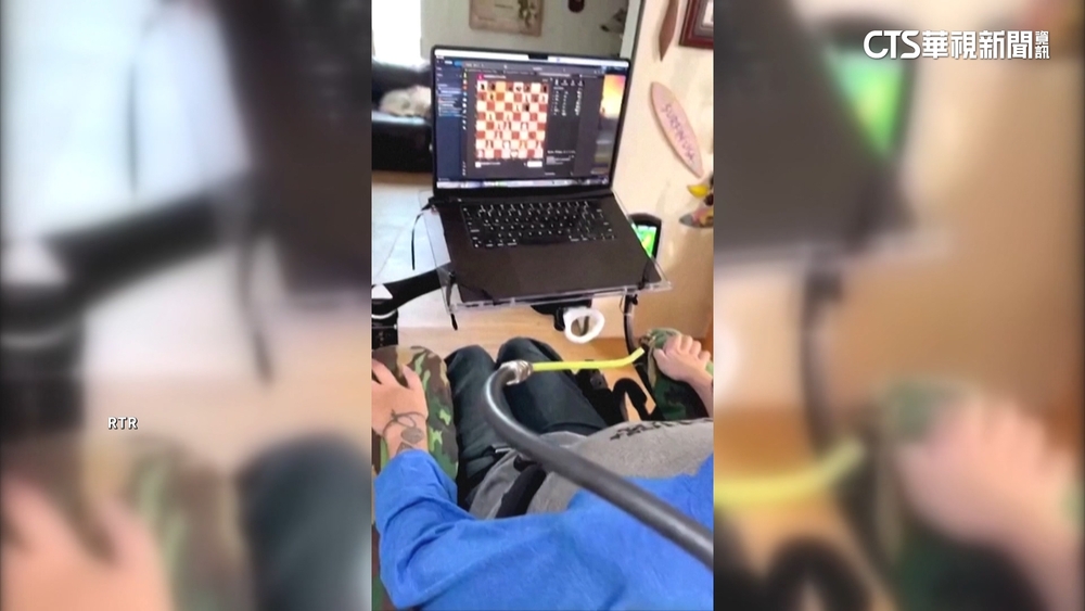 奇！　首位癱瘓男大腦植晶片　用意念下西洋棋