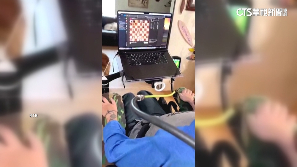 癱瘓男子大腦植晶片　可用意念下西洋棋.打電玩