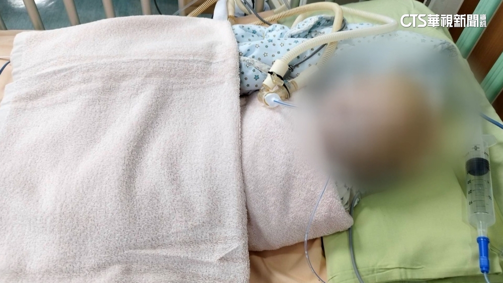 又傳虐嬰案？　5月大男嬰頭骨破碎命危　保母收押