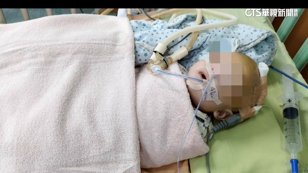 5月大男嬰疑遭虐「顱骨骨折」　保母遭羈押