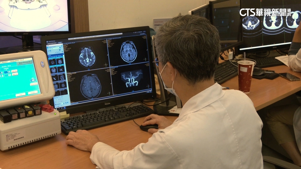 「淚之女王」腦疾真有！　台灣第3期臨床試驗中