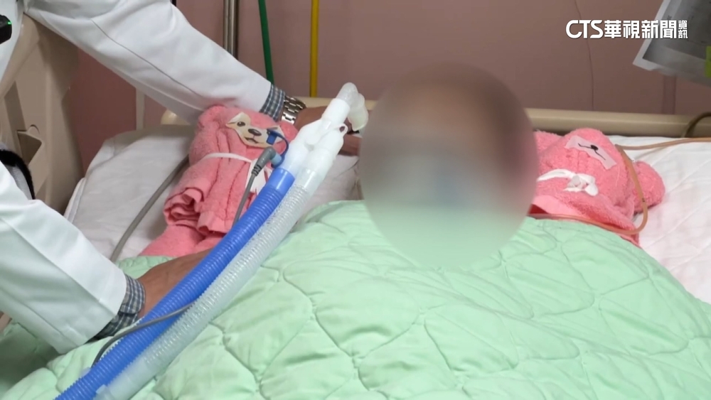 病況急轉直下！　彰化伸港車禍姐姐「昏迷指數3」