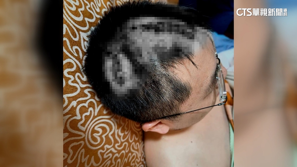 公親變事主？　檳榔攤老闆幫喬貨款　遭9男砍傷濺血