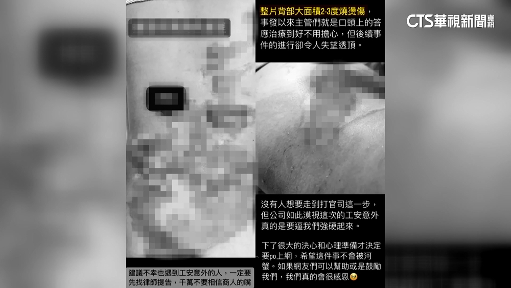 女理貨被燙傷控賠償被刁難　連鎖壽司：會負責