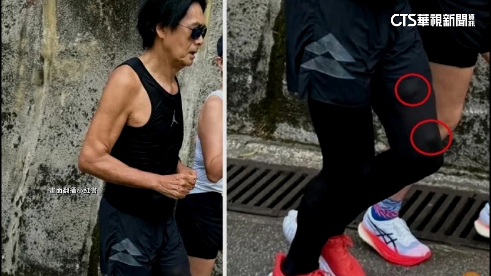 周潤發大腿驚冒2凸起物？眼尖網友憂腫瘤籲就診