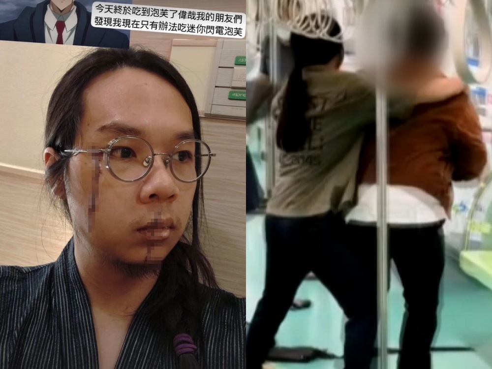 中捷英雄「長髮男」近況曝光！　臉上留兩道長傷痕　還開玩笑道：終於吃到泡芙