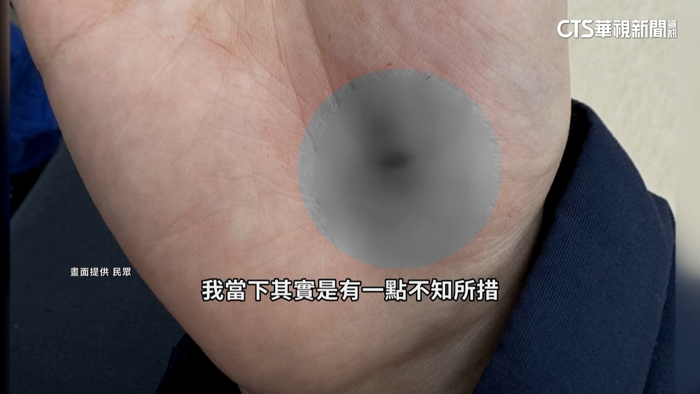 球池藏剪刀！　家長遭刺濺血提告　業者拒回應