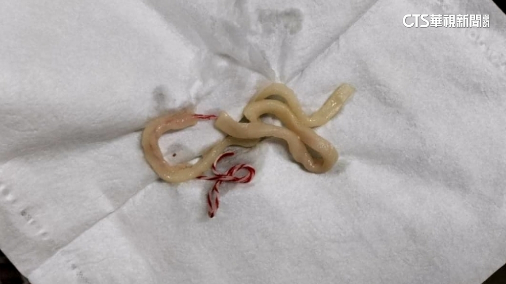 客控牛肉麵有棉線「被加料」　店家歉：疑麵粉袋掉落