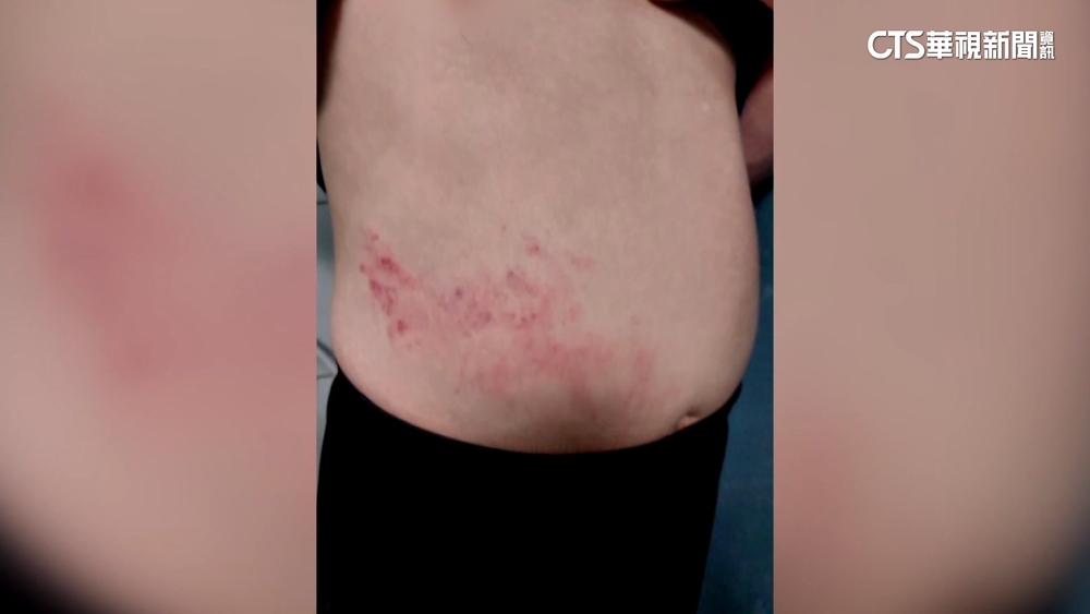 宏恩龍安分院幹部被控虐病患！　　扯辯治療　傷害罪起訴