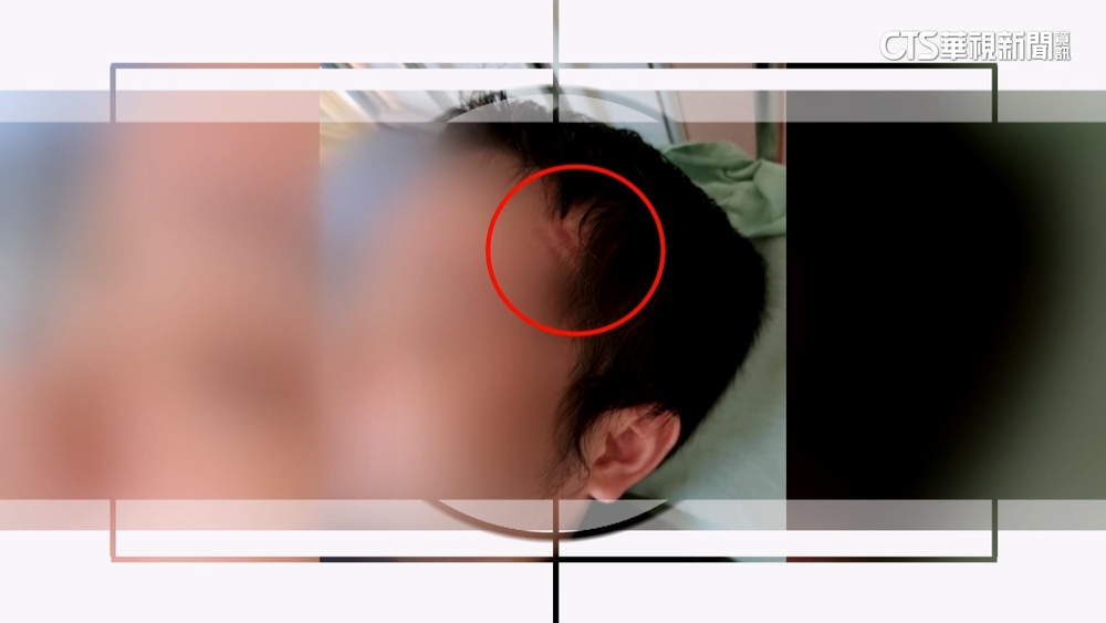 毆病患稱物理治療　宏恩醫院護佐傷害罪起訴