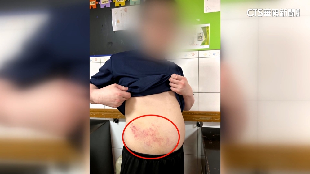 台中宏恩總院長致歉駁施虐　病患父不接受已提告