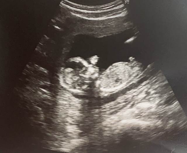 過世兒託夢「很快回去找你們」　新生兒和父母竟同天生日