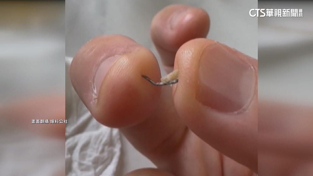 肉蛋吐司名店爆食安？客外帶蛋餅咬到「鐵屑」