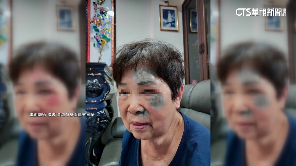 桃林步道木板凸起害婦摔　桃市府：全面整修