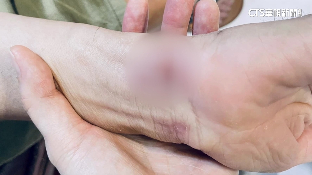 控長輩遭不當綑綁手腕釀傷　護理中心：檢討疏失