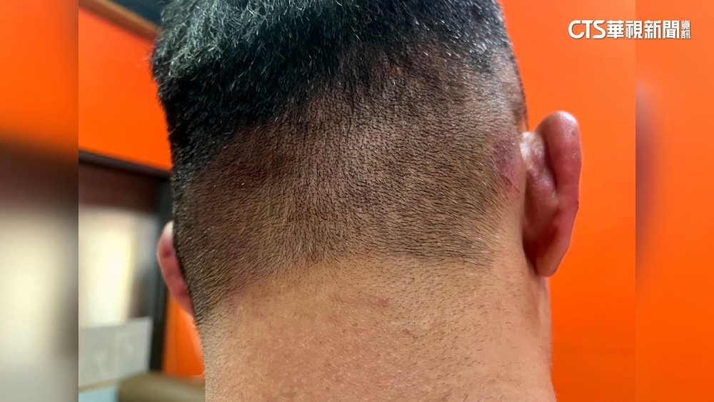 KTV幹部遭圍毆疑警吃案　警駁：欲調監視器遭拒