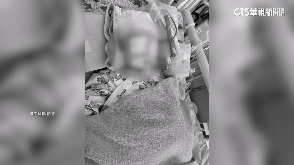 女嬰送托保「腦出血」恐成植物人　檢調查是否受虐