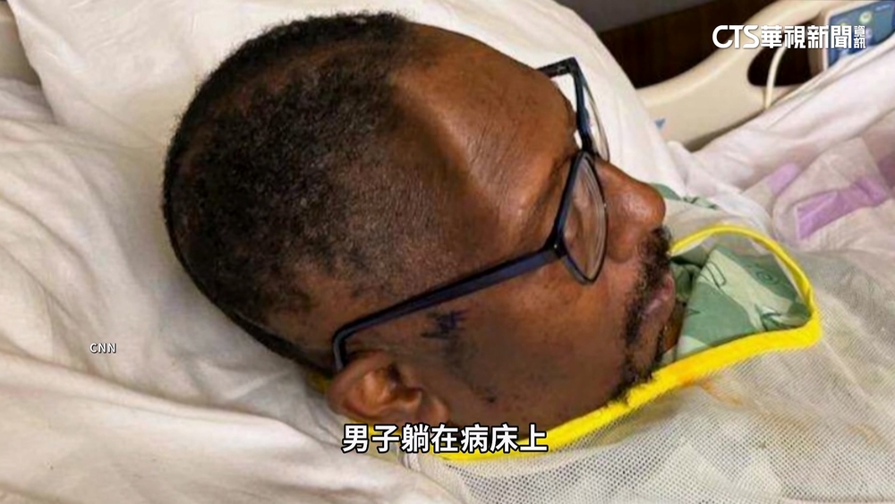 離譜！男腦出血開刀「頭骨被搞丟」　怒告醫院