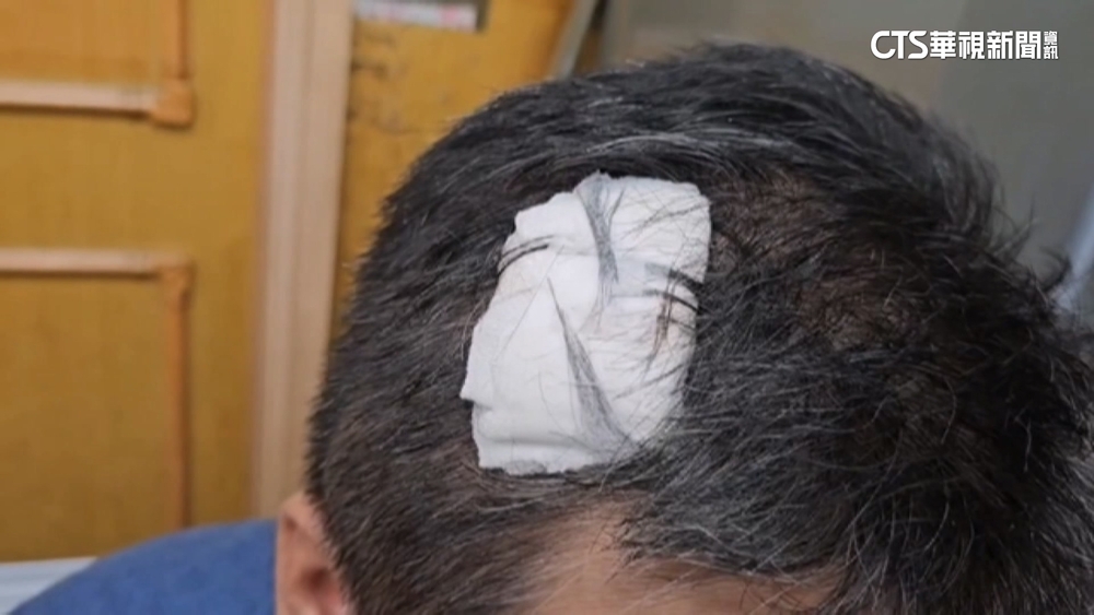 不滿買徽章壞掉　男蒙面帶榔頭回商店攻擊老闆