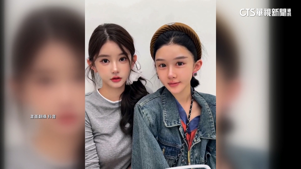 中國掀「幼態臉」整容潮！網紅成模版　逾5百人動刀