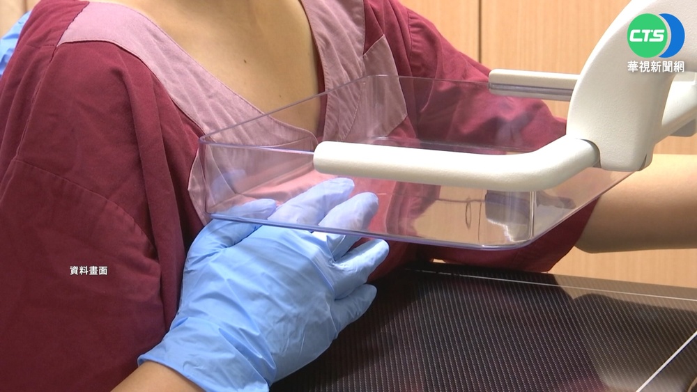 40歲就可篩！乳癌年輕化 明年起放寬篩檢年齡「上下＋5歲」