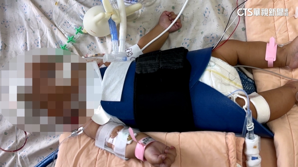 4月嬰噎到恐腦死　保母要家長送醫：3G手機無法撥打