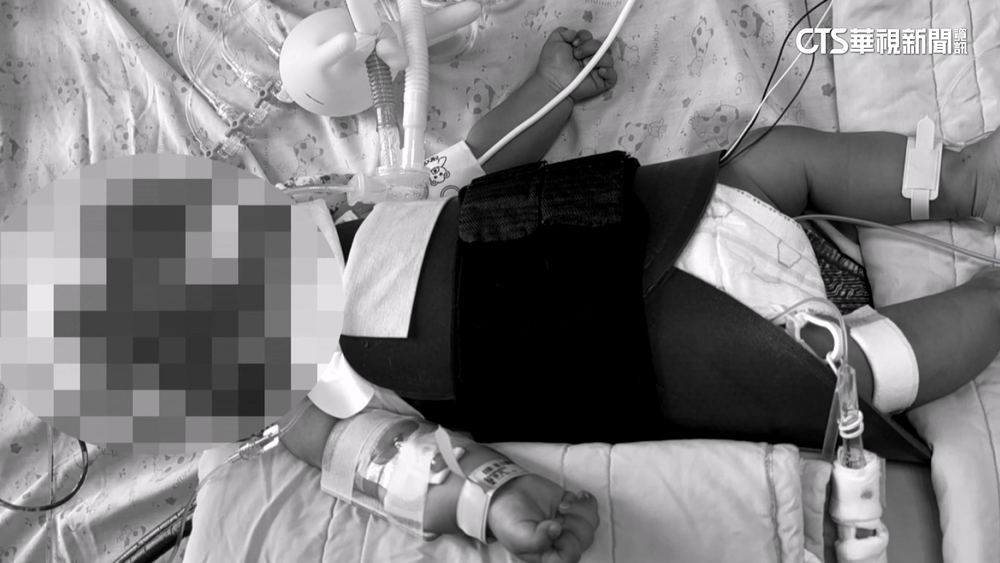 4月大男嬰腦死拔管　母質疑保母施虐「心裡有鬼」