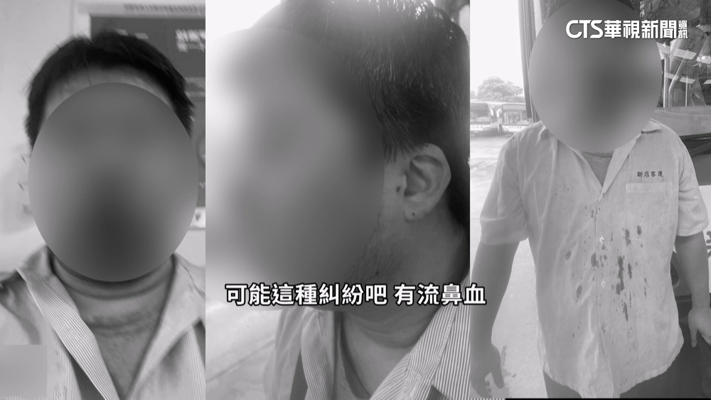 客運駕駛爆超車糾紛暴打同事　被害人怒提告