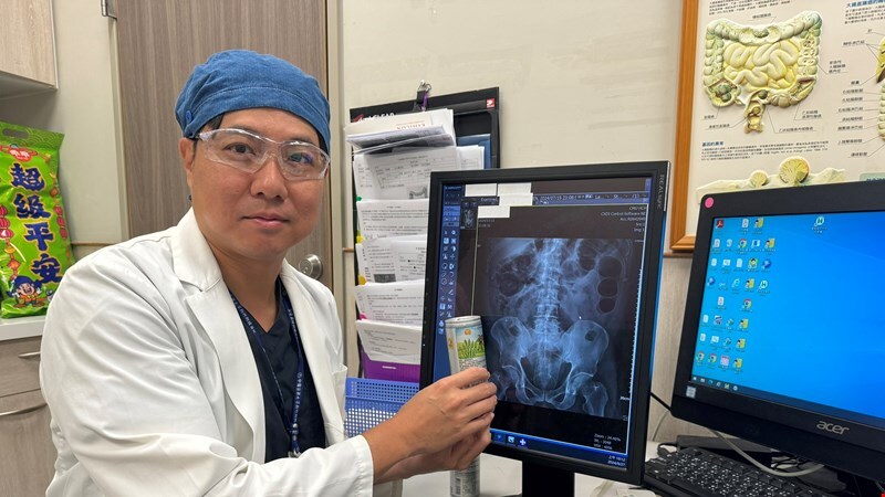 50歲男肛門塞罐裝飲料　中醫大新竹附醫靠微創手術取出
