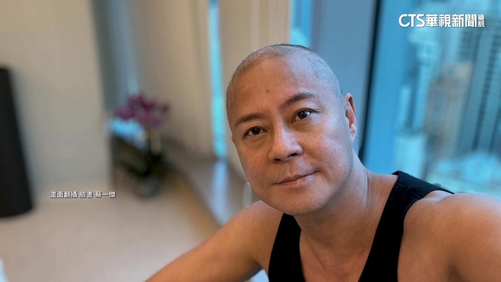 「草蜢」蔡一傑曝得「腦瘤」　PO術後傷疤照報平安